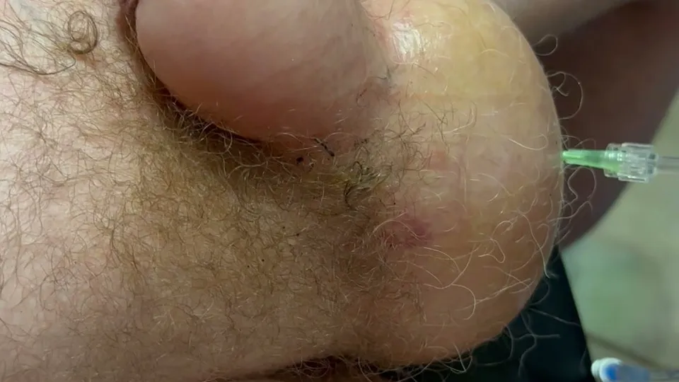 Gay Saline Enema CBT