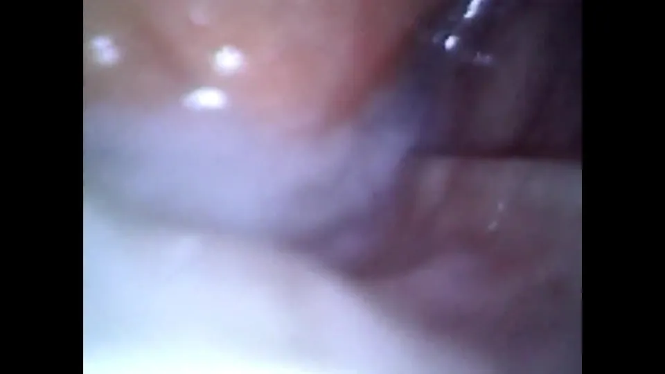 Anal Endoscopy: Cum Filled Ass Inspection
