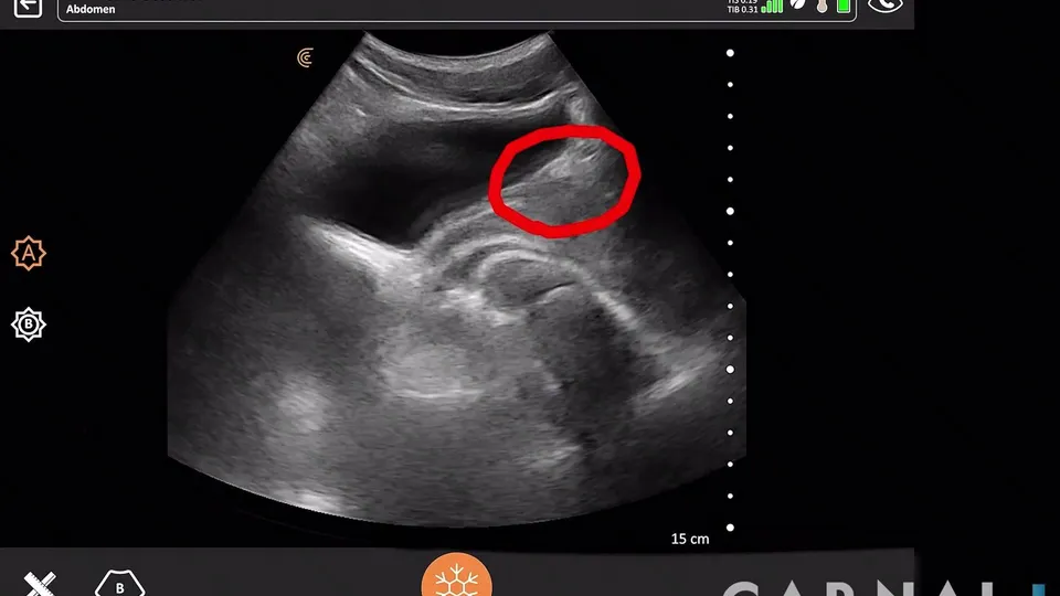 Deeper Deep Throat Volume 1 – Deeper Look