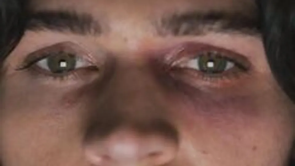 Exploité