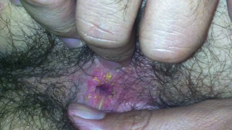 Exploring Dirty Hairy Ass - gay scat porn at ThisVid tube