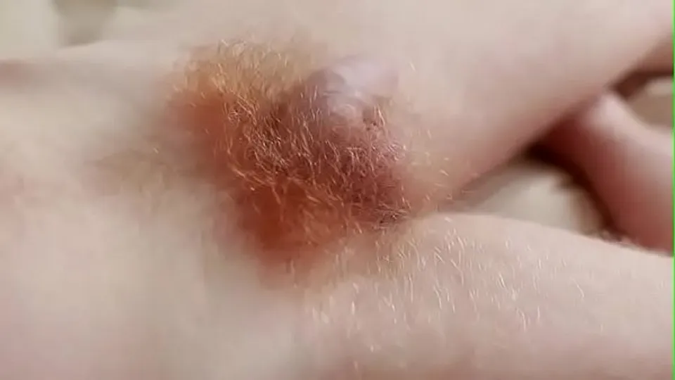 Gingers (2013)
