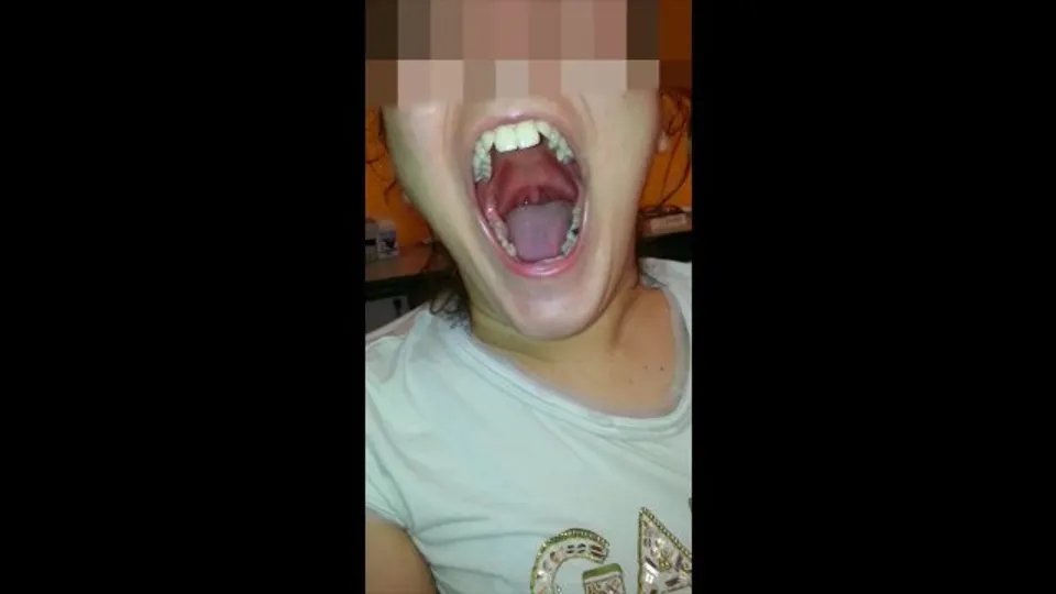 Girl Huge Mouth & Long Tongue pt2