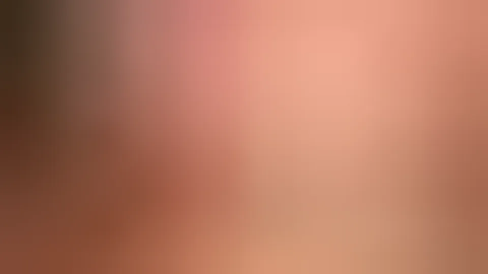 تهييج وتضرب