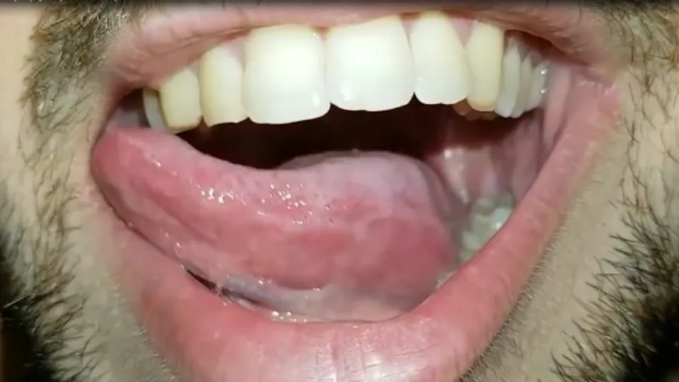 Inside his mouth vore - waiting to eat you - ThisVid.com