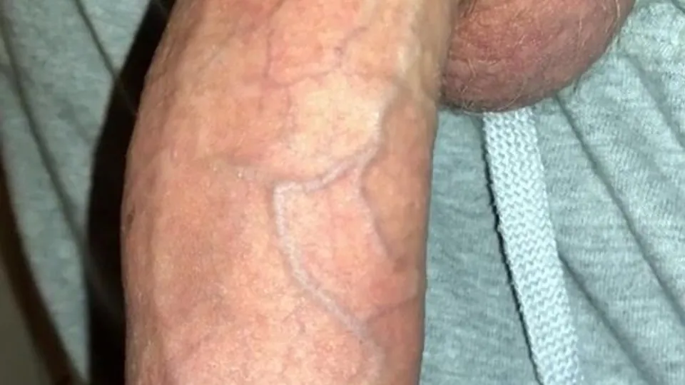 NICCEEE PEEEE