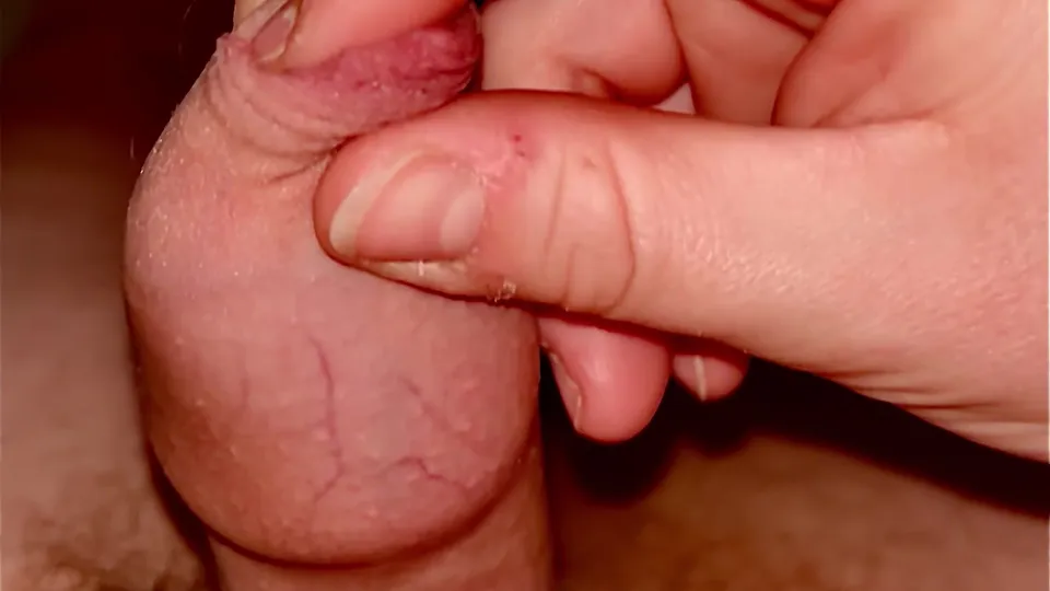 Phimosis stretching handjob